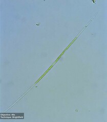 Closterium