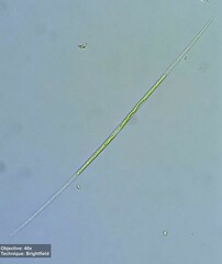 Closterium