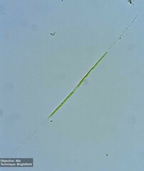 Closterium