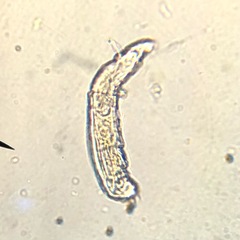 Bdelloidea
