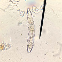 Bdelloidea