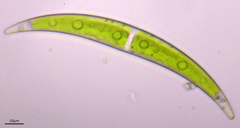 Closterium dianae
