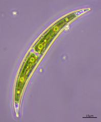 Closterium dianae