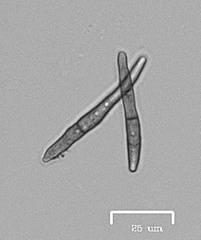 Ruptoseptoria unedonis