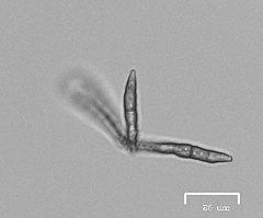 Ruptoseptoria unedonis