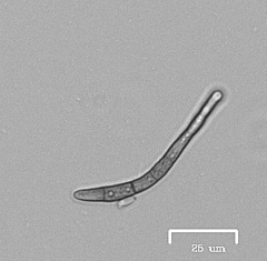 Ruptoseptoria unedonis