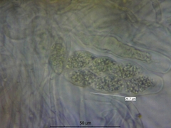 Leptogium cochleatum