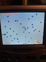 Albatrellus avellaneus