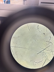 Fusarium oxysporum