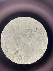 Fusarium oxysporum