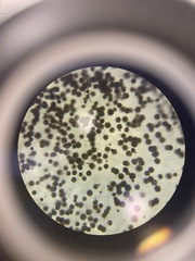 Aspergillus niger