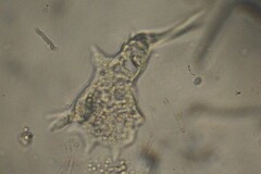 Amoebidae
