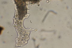 Amoebidae