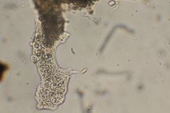 Amoebidae