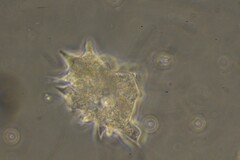 Amoebidae