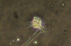 Amoebidae