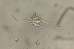 Amoebidae