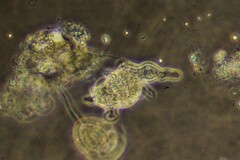 Amoebidae