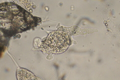 Amoebidae