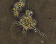 Amoebidae