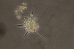 Amoebidae