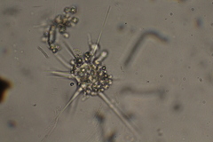 Amoebidae