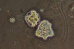 Amoebidae