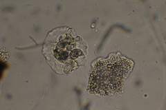 Amoebidae