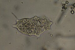Amoebidae