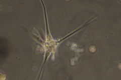 Amoebidae