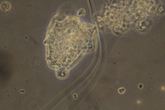 Amoebidae