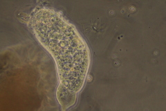 Amoebidae