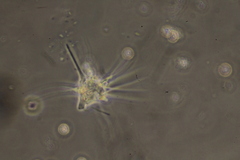 Amoebidae