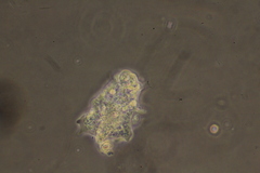 Amoebidae