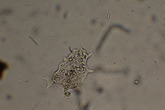 Amoebidae