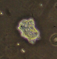 Amoebidae