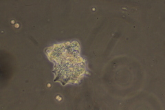 Amoebidae