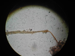 Clastoderma debaryanum