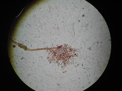 Clastoderma debaryanum