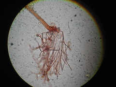 Clastoderma debaryanum