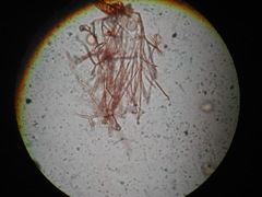 Clastoderma debaryanum