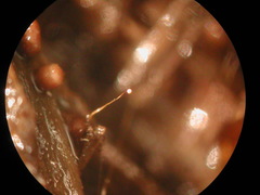 Clastoderma debaryanum