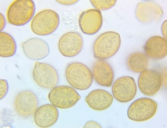 Botryobasidium simile