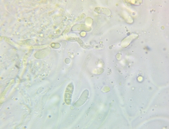 Dacrymyces corticioides