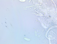 Dacrymyces corticioides