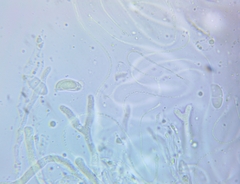 Dacrymyces corticioides