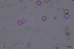 Arcyria insignis