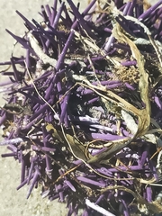 Heliocidaris erythrogramma