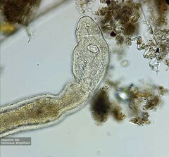Catenulida