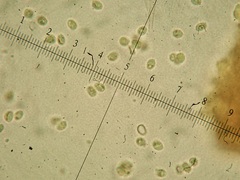 Lepiota parvannulata